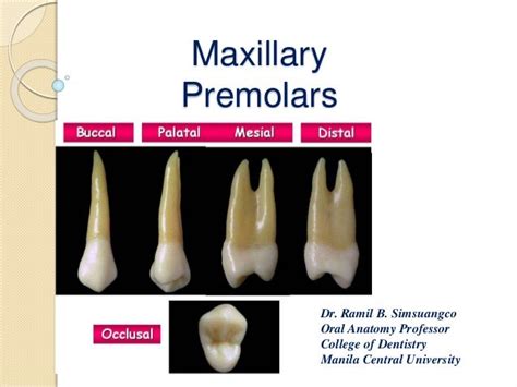 Maxillary First Premolar Root Canal Anatomy