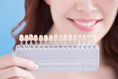 10 Facts Should Know About Teeth Whitening