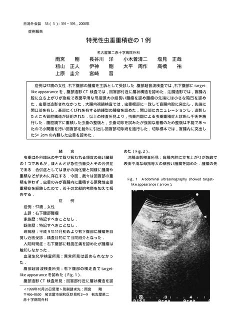 Pdf A Case Of Idiopathic Appendiceal Intussusception