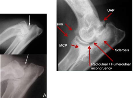 Orthopaedic Problems In The Elbow Joint Flashcards Quizlet