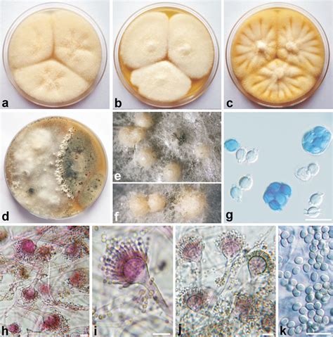 Aspergillus Felis CCF 4497 Ac Colonies Incubated 7 Days At 25 C On