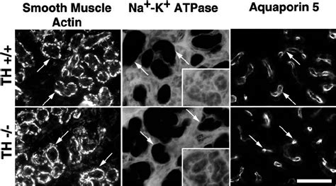 Histochemical And Immunocytochemical Characterization Of Cells Present