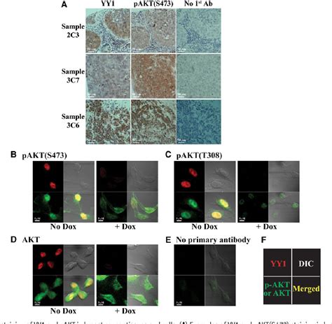 Figure 2 From Yin Yang 1 Promotes MTORC2 Mediated AKT Phosphorylation