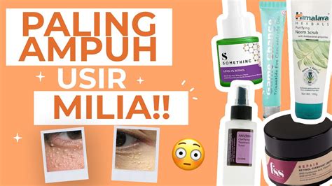 Dari 20 Ribuan 5 Skincare Terbaik Menghilangkan Milia Youtube