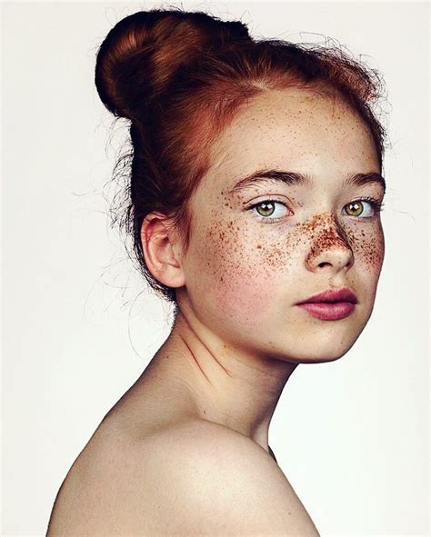 Photographer Takes Portraits Of Freckled People To Celebrate Their