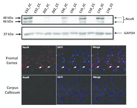 Frontal Cortex Is Enriched For Neuronal Cells A Western Blot For