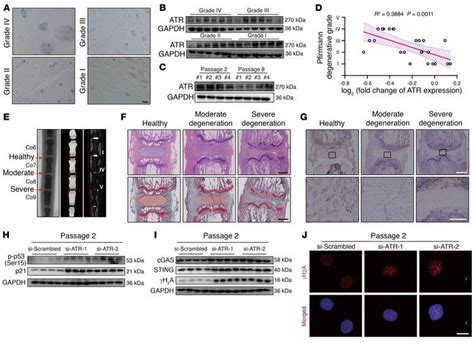 Jci Disassembly Of The Trim56 Atr Complex Promotes Cytodnacgassting