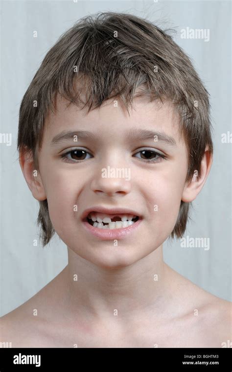 Un Jeune Gar On Sans Ses Deux Dents De Devant Photo Stock Alamy