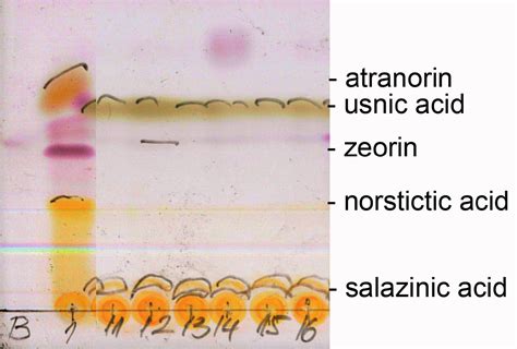 A New Steppe Element In The Vienna Basin The First Record Of