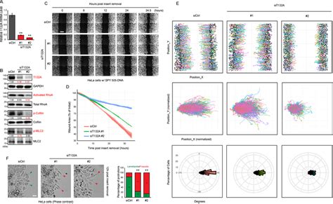 Tmem132a Regulates Cell Migration In Wound Healing Assay In Hela Cells