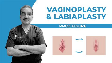 Vaginoplasty Before After Surgery Dr Soni YouTube