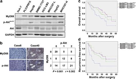 Combination Of Myd88 And P Akt Provides Better Prognostic Value For