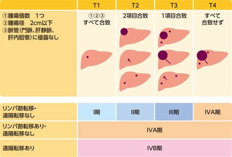 肝細胞がんhccの病期 患者の皆様 武田薬品工業株式会社