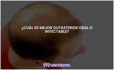 Dutasteride Oral Vs Inyectable Cu L Es M S Efectivo Mesoterapia