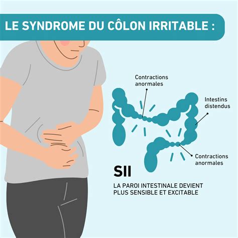 Syndrome Du C Lon Irritable Sympt Mes Causes Et Traitement