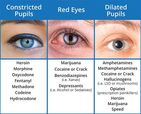 One of the first signs of drug use is noticeable changes to the eyes (bloodshot, dilated pupils ...