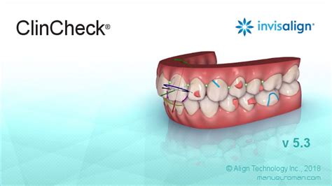 ClinCheck De Invisalign YouTube