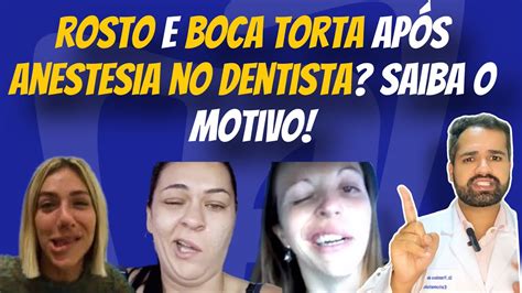 Boca torta após anestesia no dentista Saiba o motivo e como resolver