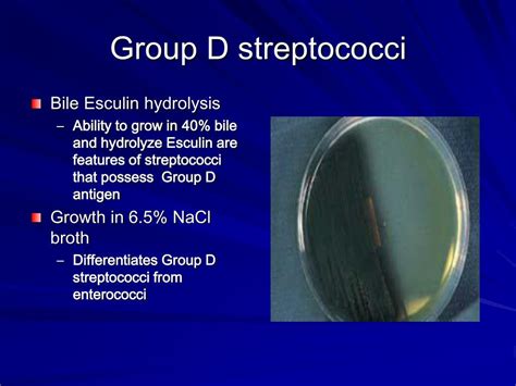 Ppt Diagnosis Of Streptococci Powerpoint Presentation Free Download