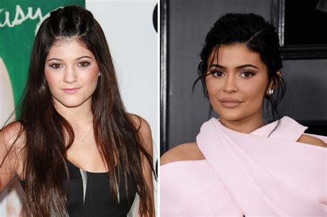 Kylie Jenner's Transformation: Personal Life & Career - OtakuKart