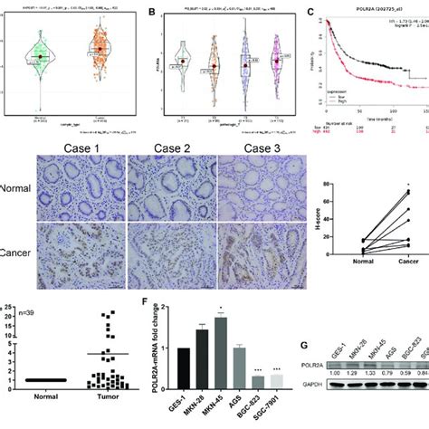 POLR2A Was Highly Expressed In GC Tissues And Showed Differential