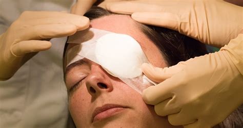 Cataract Surgery Recovery Immediately After Surgery And Beyond