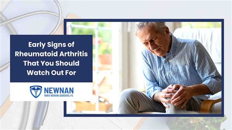 Early Signs Of Rheumatoid Arthritis That You Should Watch Out For