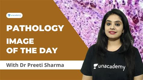 Pathology Image Of The Day 1 Dr Preeti Sharma YouTube