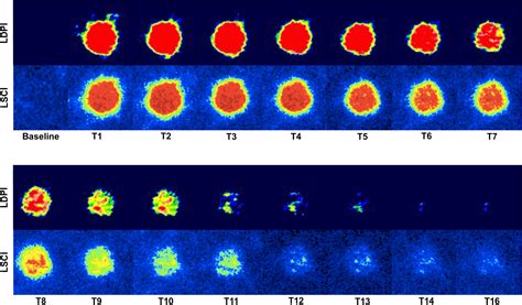 Comparison Of Laser Speckle Contrast Imaging With Laser Doppler