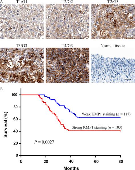 A Novel Monoclonal Antibody KMP1 Has Potential Antitumor Activity Of