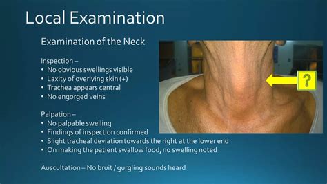 Zenkers Diverticulum Ppt