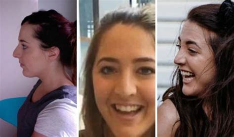 Why I regret my nose job (and I've had two) 