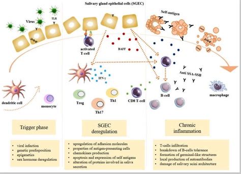 Sjogrens Syndrome Causes Genes Solutions