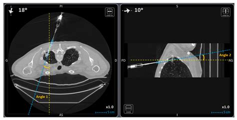 Diagnostics Free Full Text Computed Tomography Navigation