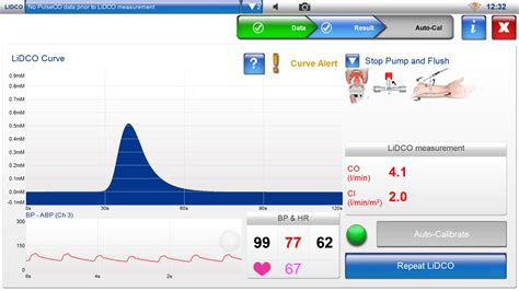 Lidcoplus Lidco Hemodynamic Monitoring For The Entire Patient Pathway