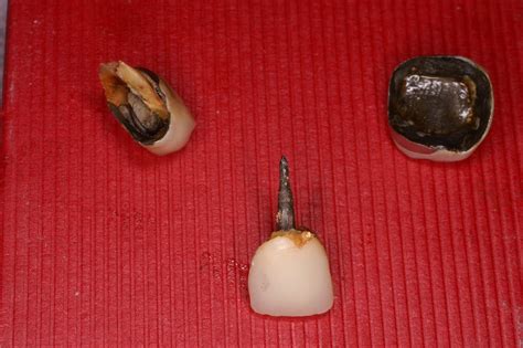 Straight from the Dentist's Mouth: 2011Straight from the Dentist's ...