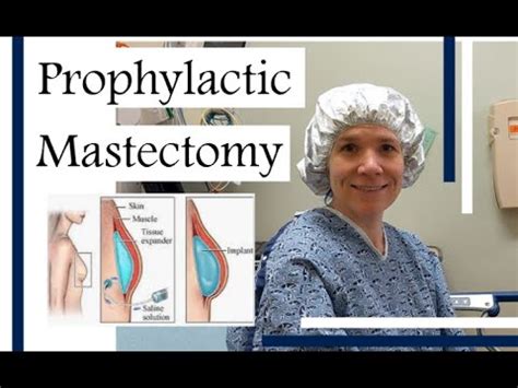 Prophylactic Mastectomy Recap Review Youtube