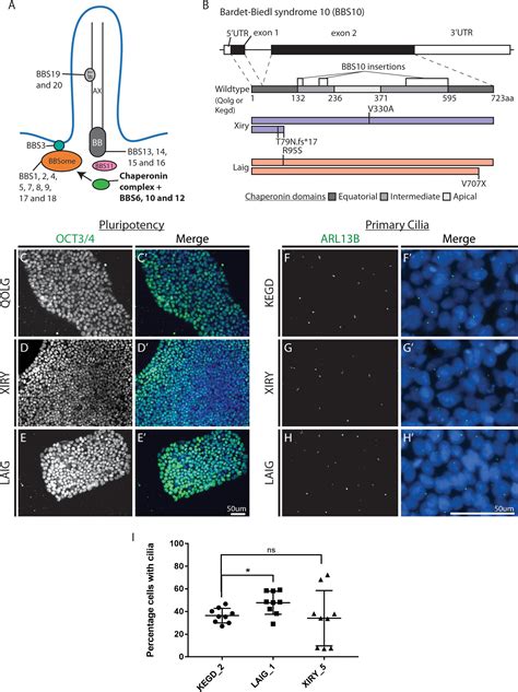 Frontiers Induction Of Neural Crest Stem Cells From Bardetbiedl