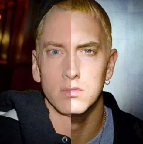 Eminem before and after plastic surgery 01 | Celebrity plastic surgery ...