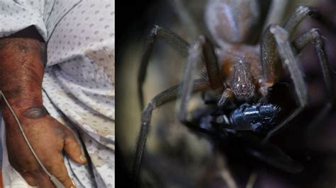 ¿cómo Prevenir Picadura De Araña Violinista Una De Las Más Letales Mvs Noticias