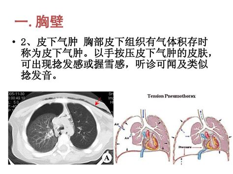 呼吸系统的解剖生理及肺部听诊word文档在线阅读与下载无忧文档