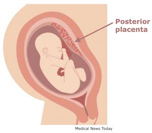 Placenta Positions And How They Impact Your Pregnancy And Birth