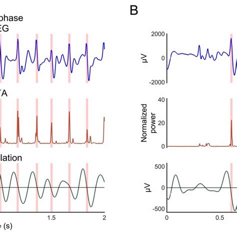 Intracranial Electroencephalography Ieeg Signals High Frequency Download Scientific Diagram