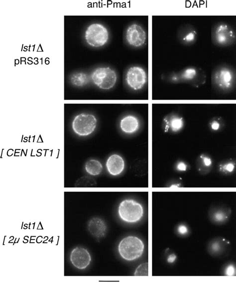 Pma P Accumulates The Er In Lst Cells And This Accumulation Is