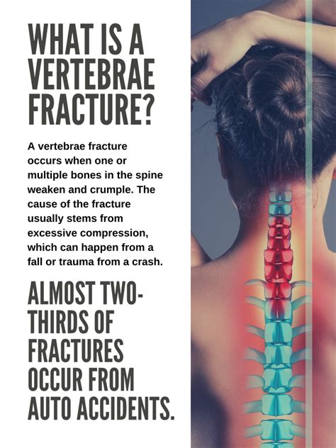 Value of Vertebrae Fracture Personal Injury Cases | Law Offices of ...