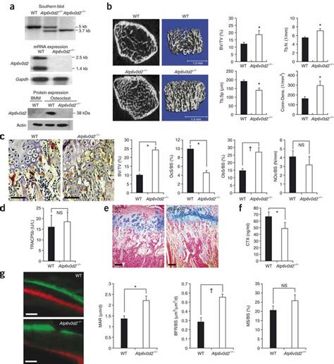 Deletion Of Atp V D Leads To Defective Osteoclasts And Increased Bone