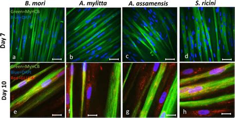 Human Skeletal Muscle Myoblasts HSMMs Differentiate To Form Myotubes