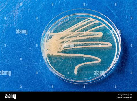 Cultures Growing On Petri Dish Stock Photo Alamy