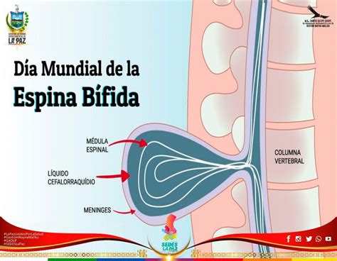 DÍA INTERNACIONAL DE LA ESPINA BÍFIDA INAMEN