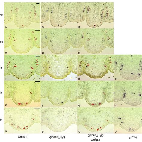 Expression Of Mash 1 Ggust T1R2 And Prox 1 During Postnatal